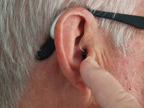 Hearing Solutions Explained: Cochlear Implants vs. Hearing Aids